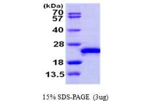 SDS-PAGE (SDS) image for Ras-Related C3 Botulinum Toxin Substrate 3 (Rho Family, Small GTP Binding Protein Rac3) (RAC3) (AA 1-189) protein (ABIN667304) (RAC3 Protein (AA 1-189))