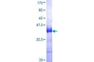 CD320 Protein (AA 97-196) (GST tag)
