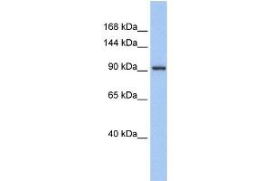 Western Blotting (WB) image for anti-Zinc Finger Protein 295 (ZNF295) antibody (ABIN2457974) (ZNF295 antibody)