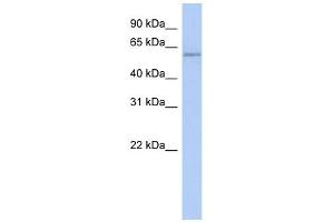Copine IV antibody used at 1 ug/ml to detect target protein. (Copine IV antibody  (N-Term))