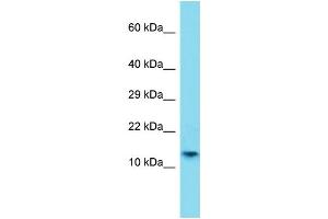 Host: Rabbit Target Name: H2AFB1 Sample Type: A549 Whole Cell lysates Antibody Dilution: 1. (H2AFB1 antibody  (N-Term))
