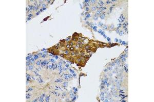 Immunohistochemistry of paraffin-embedded rat testis using PGRMC1 antibody.