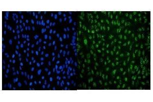 IF analysis of LSM8 using anti-LSM8 antibody (ABIN7599578).
