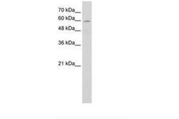 ANAPC7 antibody  (C-Term)