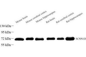 Western blot analysis of SCNN1D (ABIN7075645) at dilution of 1: 1000