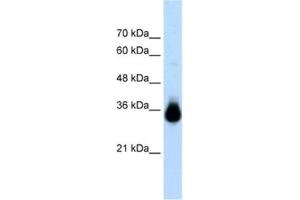 Western Blotting (WB) image for anti-Homeobox C9 (HOXC9) antibody (ABIN2461221)