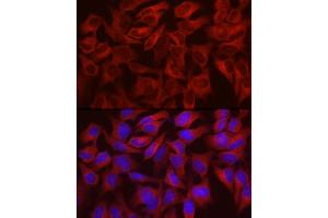 Immunofluorescence analysis of HeLa cells using WISP2 Rabbit pAb (ABIN6128928, ABIN6150226, ABIN6150228 and ABIN6216206) at dilution of 1:100 (40x lens). (WISP2 antibody  (AA 151-250))