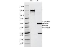 SDS-PAGE Analysis Purified gp100 / Melanosome Mouse Monoclonal Antibody (NKI-beteb).