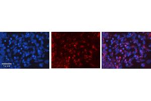 Immunohistochemistry (IHC) image for anti-Fibroblast Growth Factor 2 (Basic) (FGF2) (Middle Region) antibody (ABIN2777106)