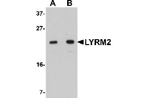 Western Blotting (WB) image for anti-LYR Motif Containing 2 (LYRM2) (C-Term) antibody (ABIN1030499) (LYRM2 antibody  (C-Term))