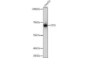 Western blot analysis of extracts of HepG2 cells, using CES1 Rabbit mAb (ABIN7266077) at 1:1000 dilution. (CES1 antibody)