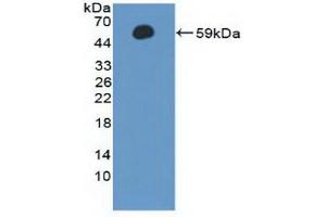 Figure. (Cyclin A1 antibody  (AA 183-430))