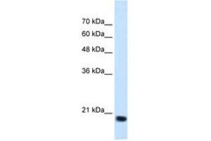 Image no. 2 for anti-Signal Sequence Receptor, beta (Translocon-Associated Protein Beta) (SSR2) (N-Term) antibody (ABIN205080) (SSR2 antibody  (N-Term))