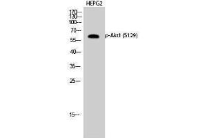 Western Blotting (WB) image for anti-V-Akt Murine Thymoma Viral Oncogene Homolog 1 (AKT1) (pSer129) antibody (ABIN3182221) (AKT1 antibody  (pSer129))