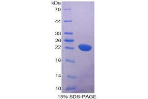 SDS-PAGE (SDS) image for CD6 (CD6) (AA 477-644) protein (His tag) (ABIN2124387) (CD6 Protein (CD6) (AA 477-644) (His tag))