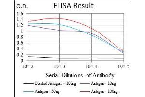 Black line: Control Antigen (100 ng), Purple line: Antigen(10 ng), Blue line: Antigen (50 ng), Red line: Antigen (100 ng), (TWIST1 antibody  (AA 9-74))