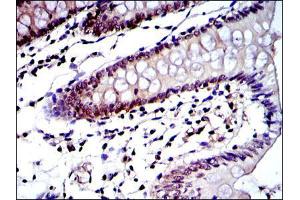 Immunohistochemistry (IHC) image for anti-Proteasome (Prosome, Macropain) Subunit, beta Type, 8 (Large Multifunctional Peptidase 7) (PSMB8) antibody (ABIN969371)