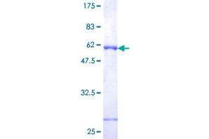 Image no. 1 for FK506 Binding Protein 7 (FKBP7) (AA 1-222) protein (GST tag) (ABIN1354136) (FKBP7 Protein (AA 1-222) (GST tag))