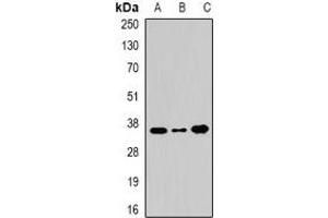 Western blot analysis of WDR5 expression in 22RV1 (A), BT474 (B), Hela (C) whole cell lysates.