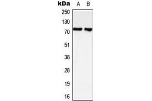 Western blot analysis of LIMK1/2 expression in HeLa (A), SHSY5Y (B) whole cell lysates. (LIMK-1/2 (C-Term) antibody)