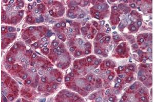 Human Pancreas: Formalin-Fixed, Paraffin-Embedded (FFPE) (ALDH3A1 antibody  (C-Term))