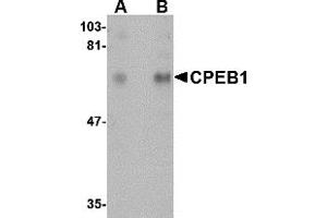 Western Blotting (WB) image for anti-Cytoplasmic Polyadenylation Element Binding Protein 1 (CPEB1) (N-Term) antibody (ABIN1031326) (CPEB1 antibody  (N-Term))