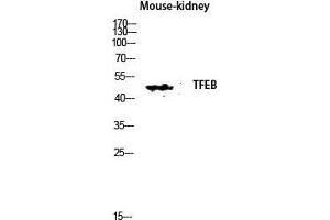 Western Blot (WB) analysis of Mouse Kidney lysis using TFEB antibody.