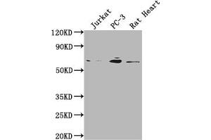 Western Blot Positive WB detected in: Jurkat whole cell lysate, PC-3 whole cell lysate, Rat Heart tissue All lanes: E2F1 antibody at 1:2000 Secondary Goat polyclonal to rabbit IgG at 1/50000 dilution Predicted band size: 47 kDa Observed band size: 60 kDa (Recombinant E2F1 antibody)
