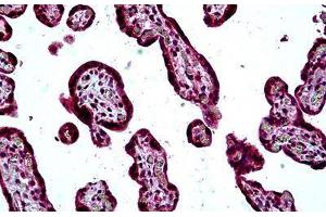 Human Placenta: Formalin-Fixed, Paraffin-Embedded (FFPE) (SH3KBP1 antibody  (AA 2-14))