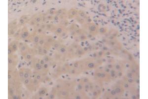 DAB staining on IHC-P; Samples: Human Liver Tissue (DDO antibody  (AA 117-199))