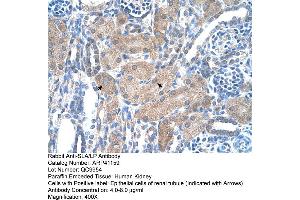 Rabbit Anti-SLA/LP Antibody  Paraffin Embedded Tissue: Human Kidney Cellular Data: Epithelial cells of renal tubule Antibody Concentration: 4. (SLA antibody  (N-Term))