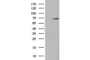 HEK293T cells were transfected with the pCMV6-ENTRY control (Left lane) or pCMV6-ENTRY EPM2AIP1 (Right lane) cDNA for 48 hrs and lysed. (EPM2AIP1 antibody)