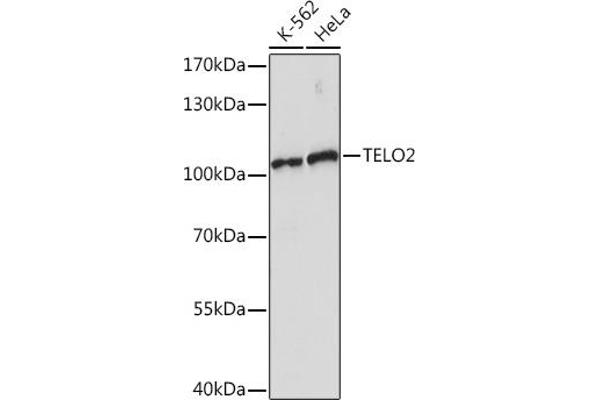 TELO2 Antikörper  (AA 450-550)