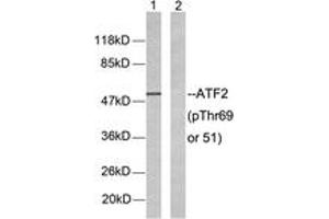 Western blot analysis of extracts from LOVO cells, using ATF2 (Phospho-Thr69 or 51) Antibody. (ATF2 antibody  (pSer69))