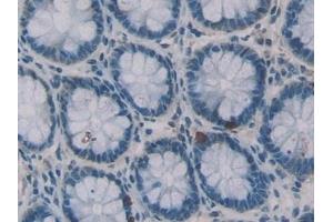 Immunohistochemistry (IHC) image for anti-Elastase, Neutrophil Expressed (ELANE) (AA 30-247) antibody (ABIN7431269)