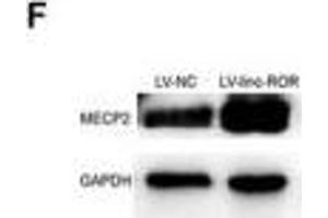 linc-ROR promoted cell proliferation, migration, and invasion of breast cancer through linc-ROR/miR-194-3p/MECP2 regulatory axis. (MECP2 antibody  (AA 1-100))