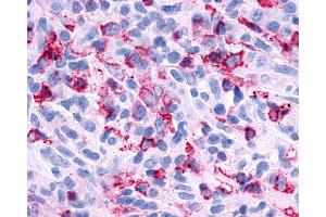 Immunohistochemistry (IHC) image for anti-Pyrimidinergic Receptor P2Y, G-Protein Coupled, 6 (P2RY6) (Cytoplasmic Domain) antibody (ABIN1049220)