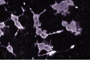 Immunofluorescence staining of PC12 cells (Rat neuroblastoma, ATCC CRL-1721). (PKC alpha antibody  (AA 270-427))
