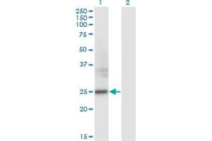 FNDC4 antibody  (AA 45-154)
