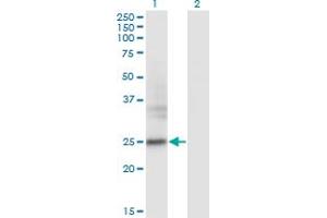 Western Blot analysis of FNDC4 expression in transfected 293T cell line by FNDC4 monoclonal antibody (M01), clone 7F9. (FNDC4 antibody  (AA 45-154))