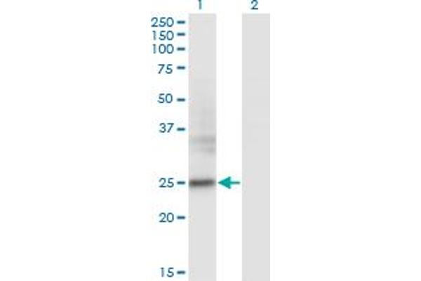 FNDC4 抗体  (AA 45-154)
