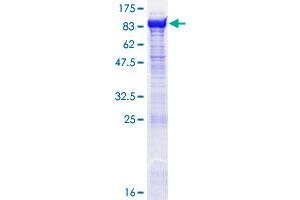 2-Oxoglutarate and Iron-Dependent Oxygenase Domain Containing 1 (OGFOD1) (AA 1-542) protein (GST tag)