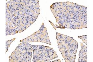 ABIN7094803 and ABIN7098854 at 1/100 staining Rat stomach tissue by IHC-P. (Asporin antibody  (C-Term))