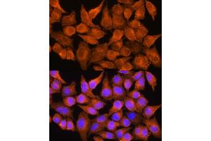 Immunofluorescence analysis of HeLa cells using  Rabbit pAb (ABIN1678678, ABIN3017841, ABIN3017842 and ABIN6220287) at dilution of 1:100. (AOX1 antibody  (AA 340-590))