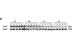 Identification of RUNX1 as an apoptosis transcription factor and an independent prognostic factor in NB tissue and cell lines. (RUNX1 antibody  (AA 221-480))