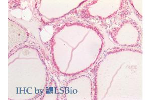 ABIN6391411 (5µg/ml) staining of paraffin embedded Human Thyroid.