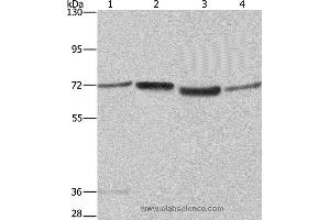 Western blot analysis of A375 and 231 cell, 293T cell and human hepatocellular carcinoma tissue , using SYN1 Polyclonal Antibody at dilution of 1:550 (SYN1 antibody)