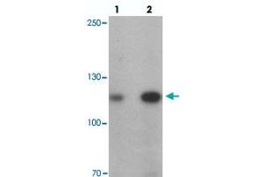 Western blot analysis of ANKRD27 in K-562 cell lysate with ANKRD27 polyclonal antibody  at (lane 1) 1 and (lane 2) 2 ug/mL. (ANKRD27 antibody  (N-Term))
