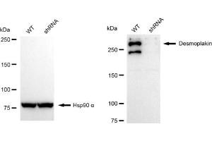 Western blotting analysis using Desmoplakin antibody (ABIN7798318). (Recombinant Desmoplakin antibody)