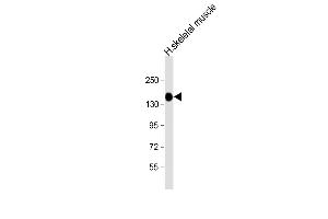 Anti-AGL Antibody (C-term) at 1:8000 dilution + human skeletal muscle lysate Lysates/proteins at 20 μg per lane.